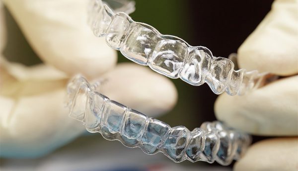 Как происходит выравнивание зубов? 