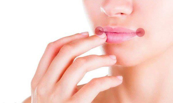Ранки в уголках губ - как и чем лечить трещинки? 