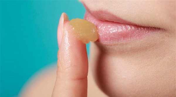 Ранки в уголках губ – как и чем лечить трещинки? 