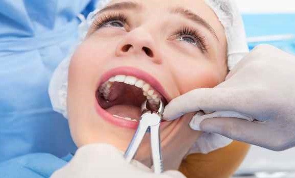 Хирургическое и нехирургическое удаление зубов: как проводятся операции 